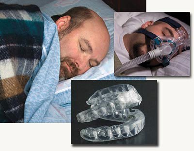 Oral-appliance-therapy-vs-CPAP-therapy