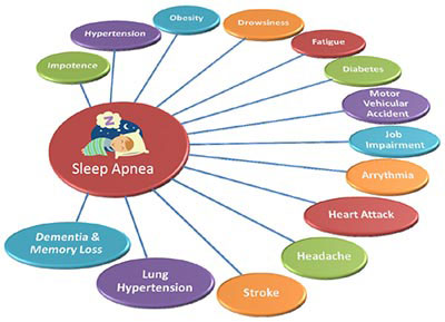 Sleep-Apnea-Complications