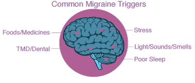 Migraine Specialist Kerala